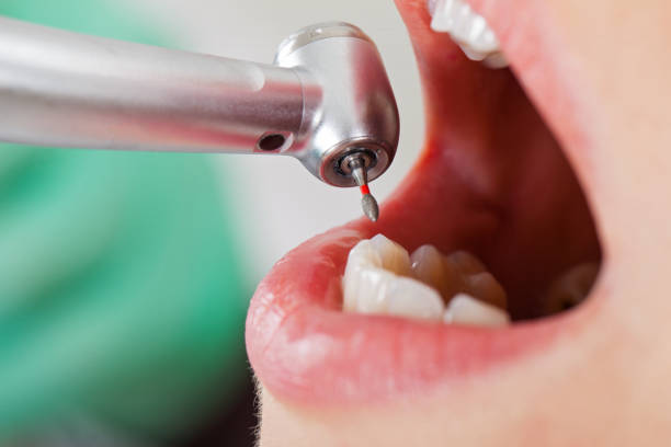 Best Pediatric Emergency Dentist in Linwood, PA